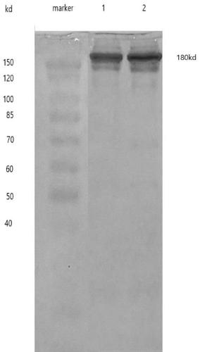 Anti-novel coronavirus antibody and preparation method and application thereof