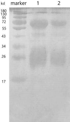 Anti-novel coronavirus antibody and preparation method and application thereof