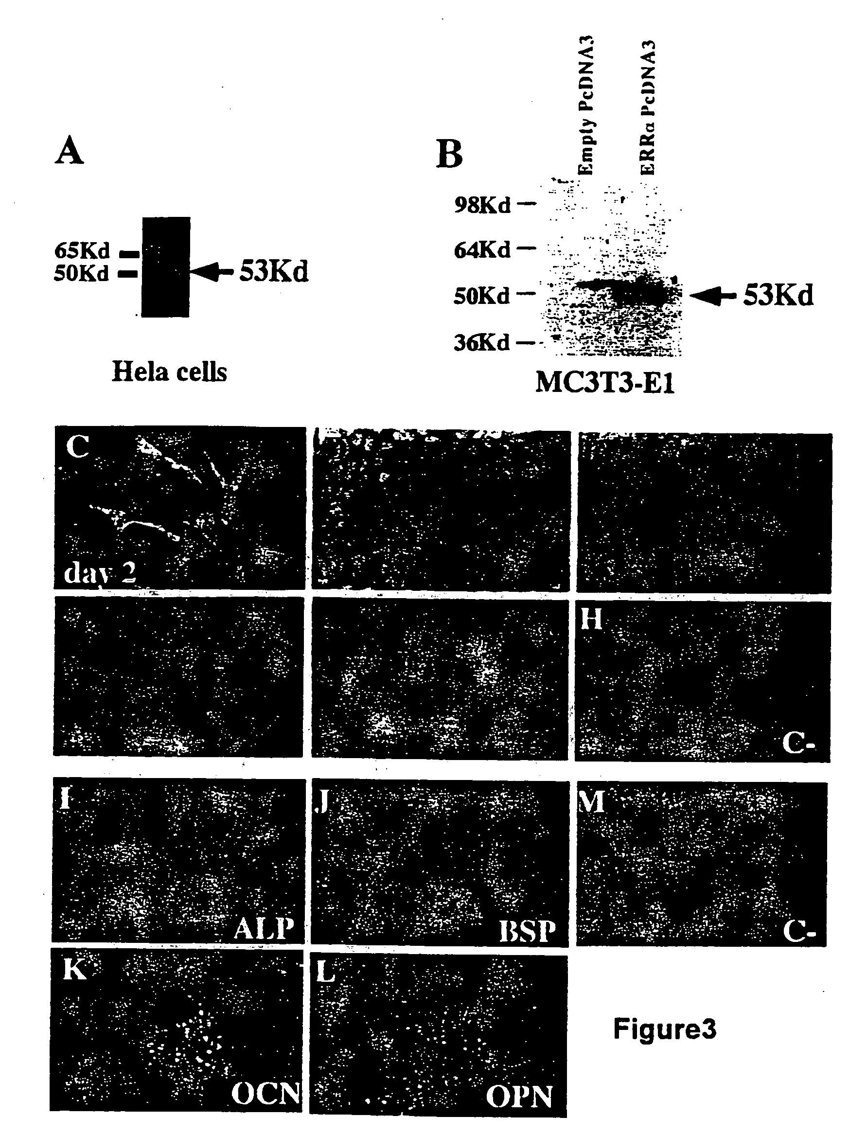 Estrogen related receptor, ERRalpha, a regulator of bone formation