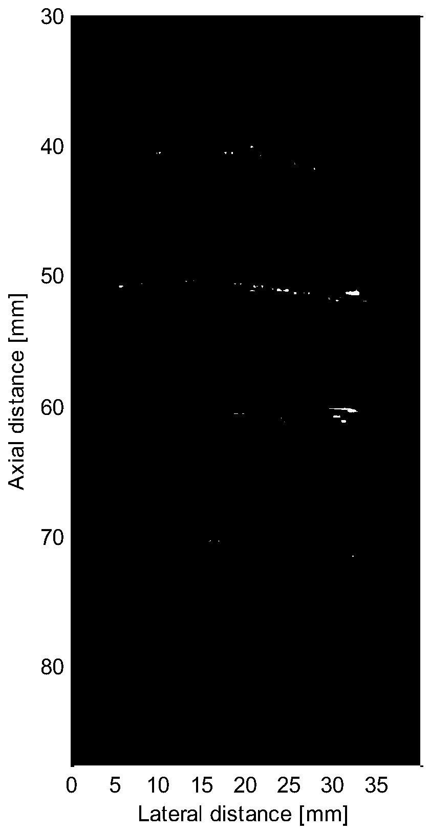 An Ultrasonic Plane Wave Imaging Method Based on Inverse Perspective Plane Transformation