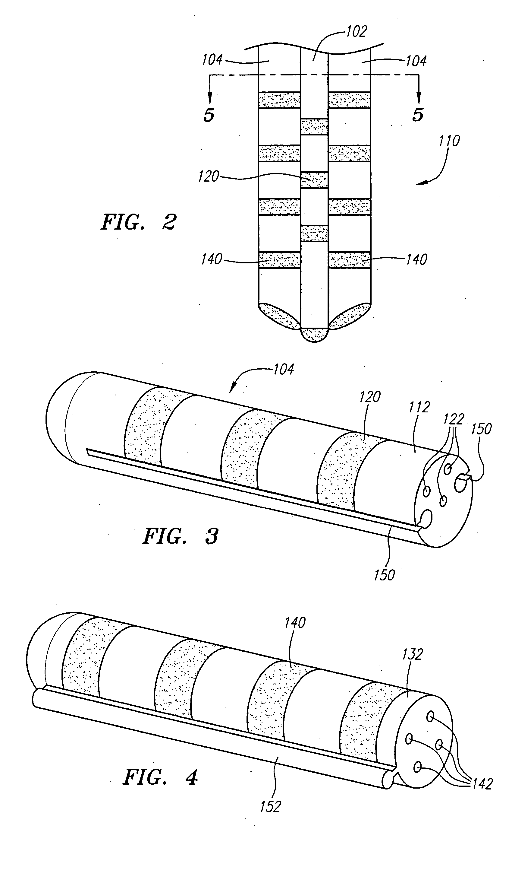 Modular stimulation lead network