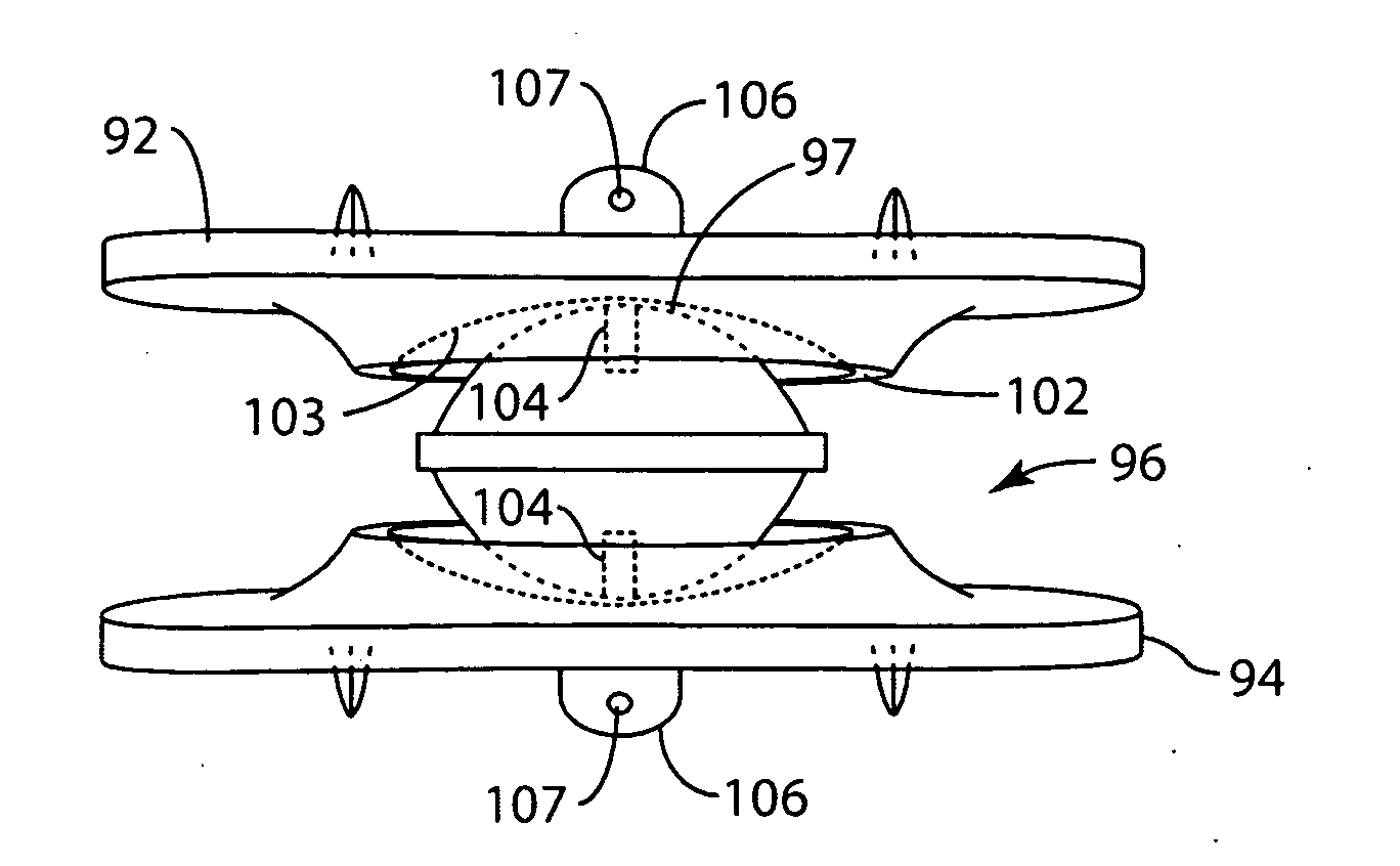 Artificial Spinal Disc