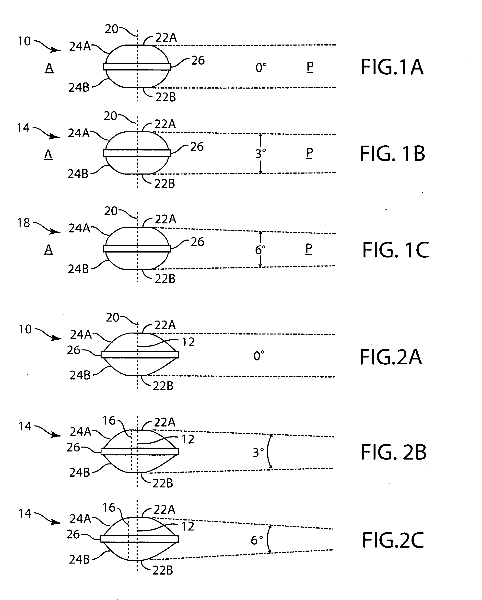 Artificial Spinal Disc