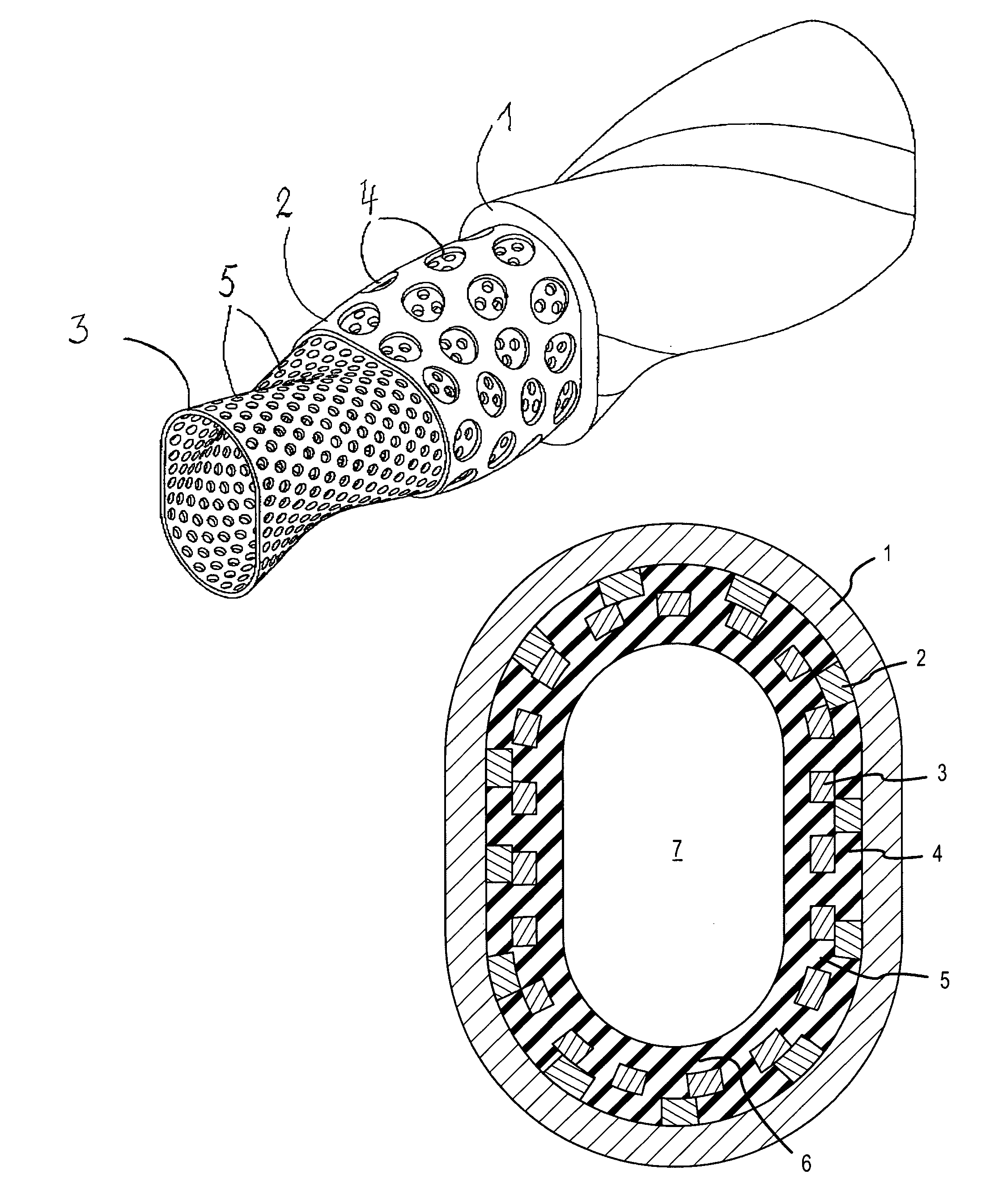 Stator for an eccentric screw pump or an eccentric worm motor operating on the moineau principle