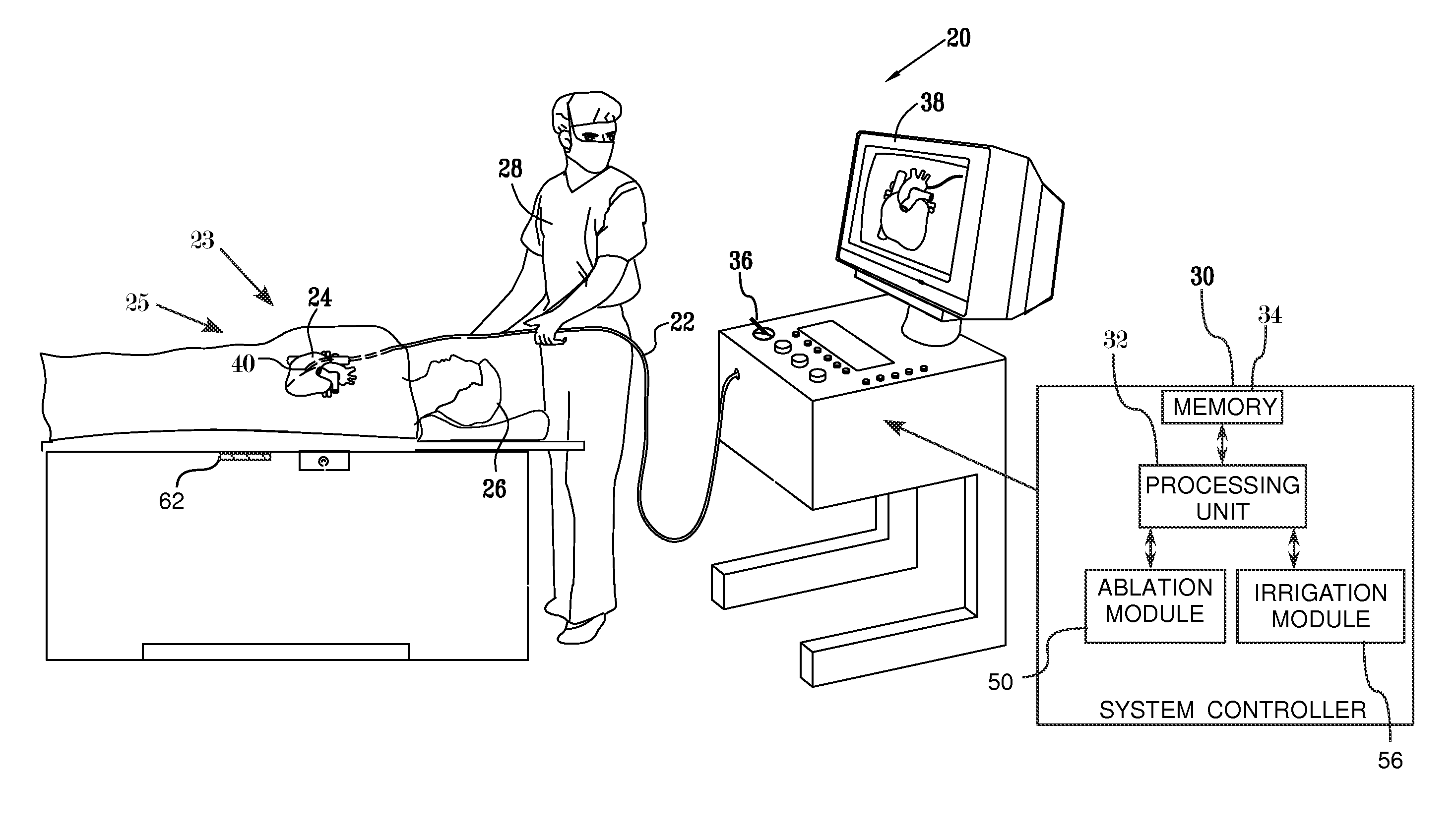 Monitoring tissue temperature while using an irrigated catheter