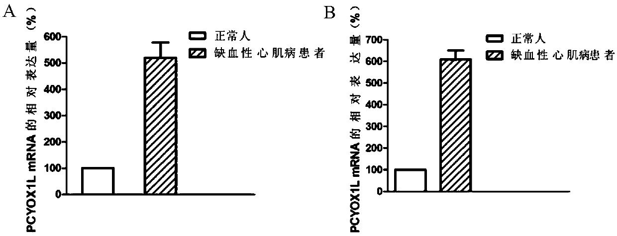 Biomarker related to ischemic cardiomyopathy occurrence and development