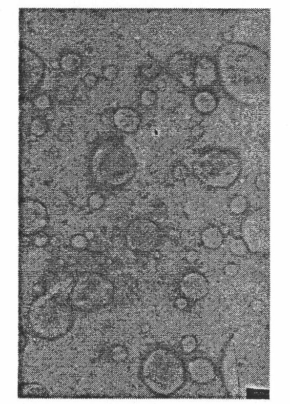 Ubenimex fat emulsion injection and preparation method thereof