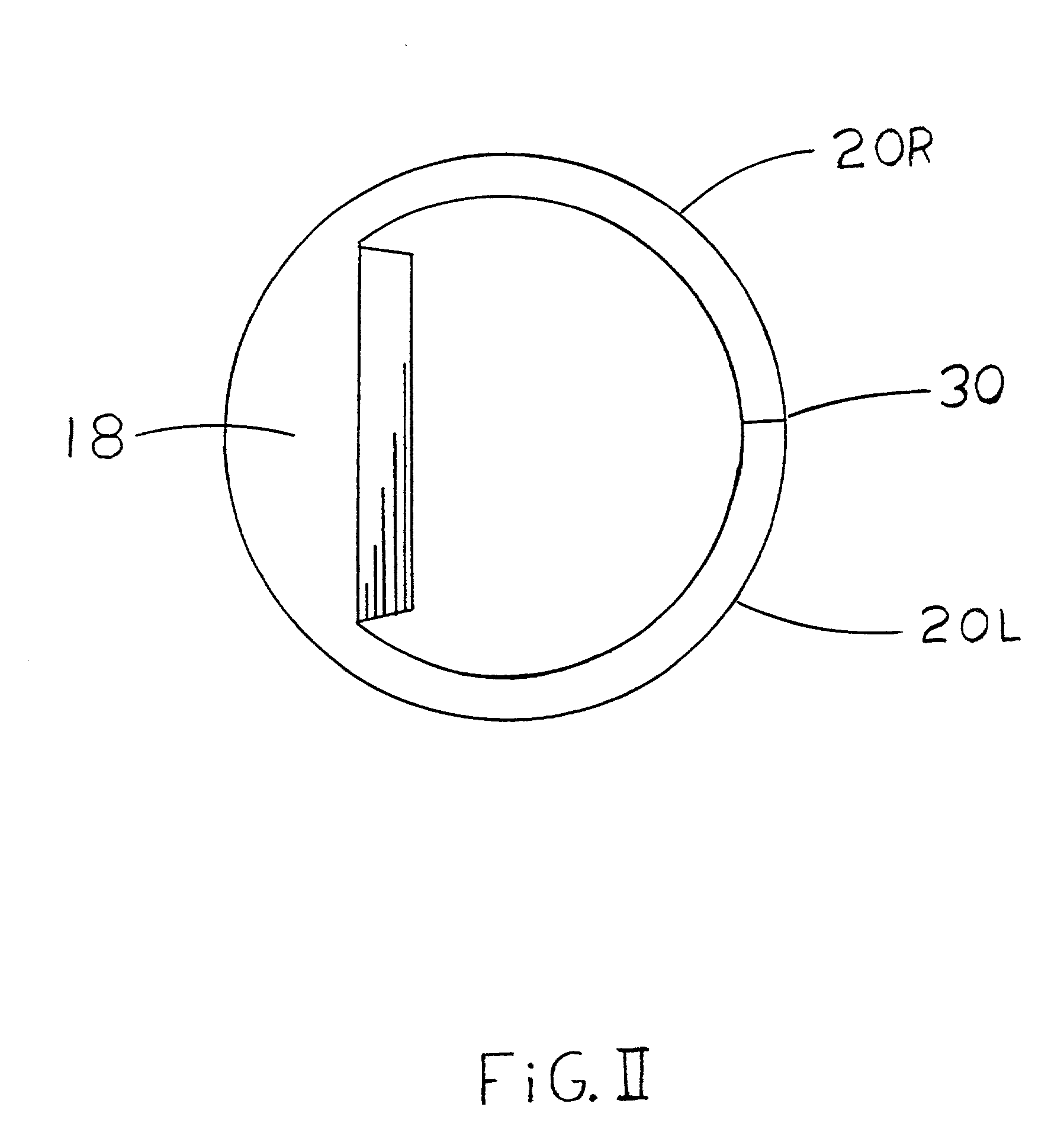 Subgrate drain basin filter