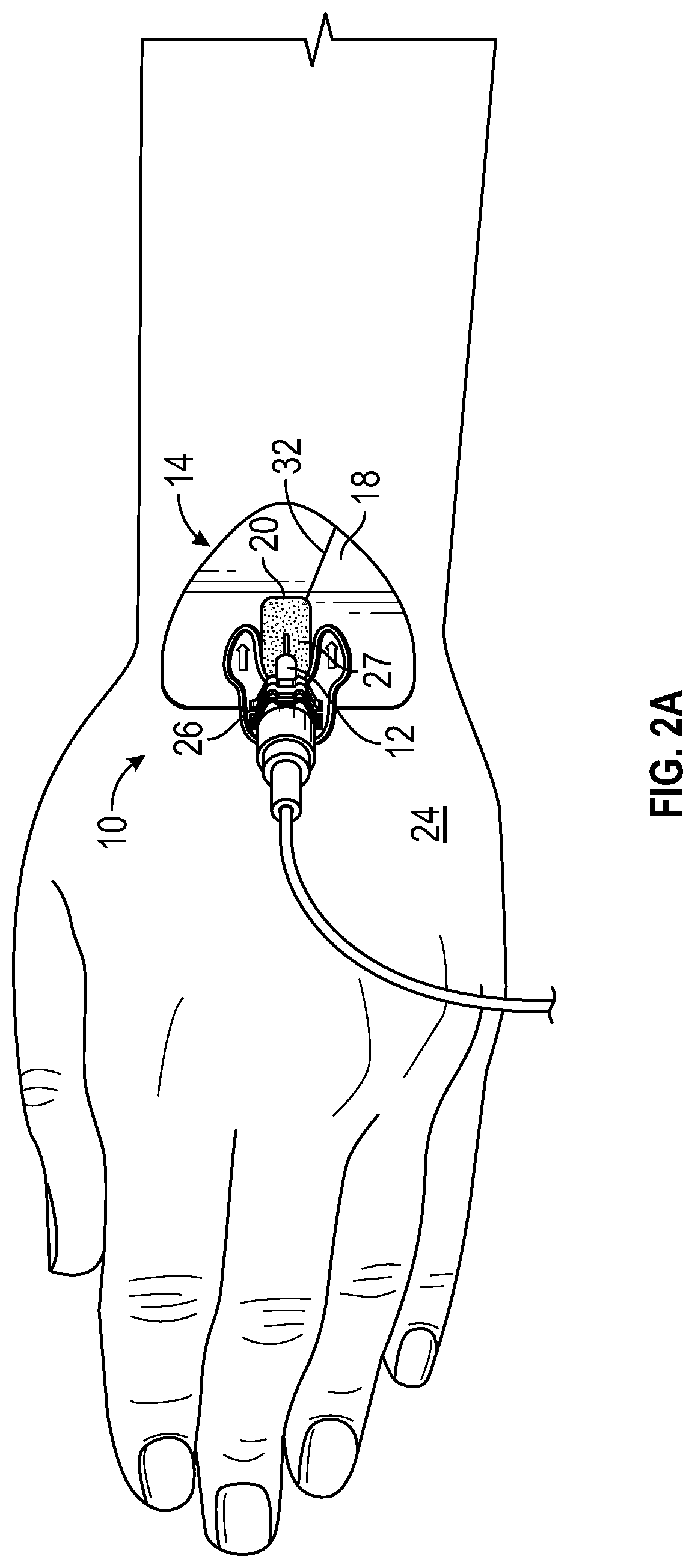 Catheter securement device with window