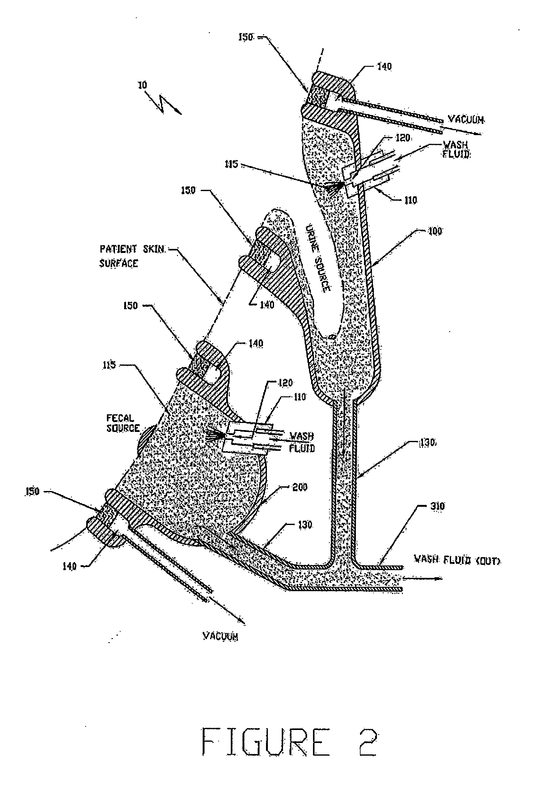 Snap-on two-piece emergence profile healing abutment