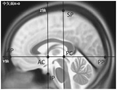 Brain nucleus positioning method and device, storage medium and computer equipment