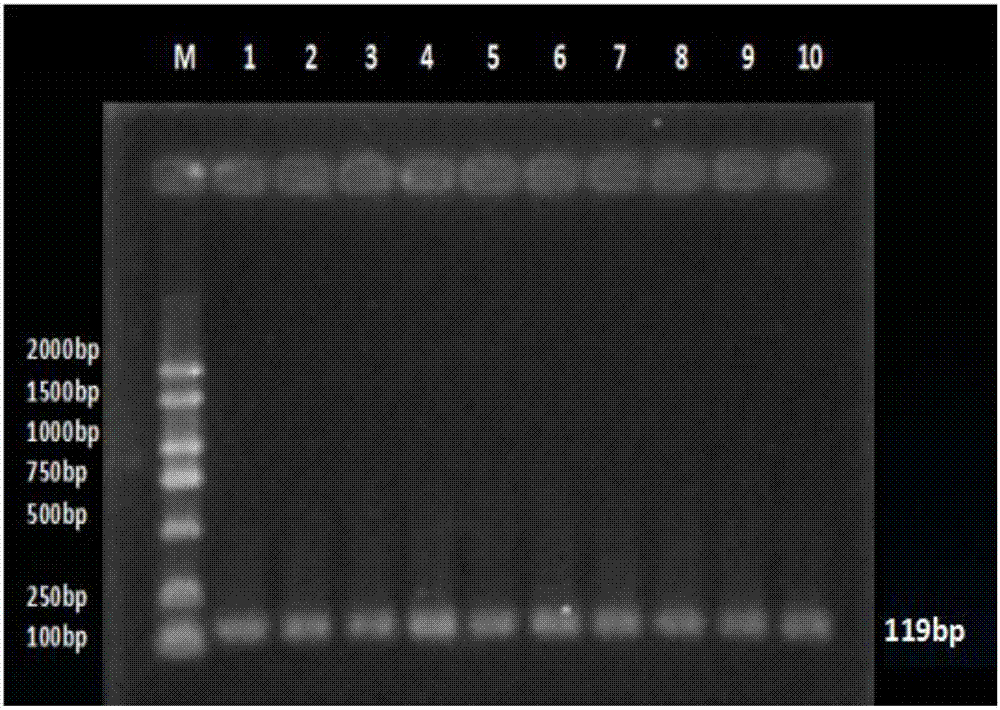 COL1A1 (collagen type 1 alpha1) gene-containing detection kit for improving Altay sheep meat quality trait