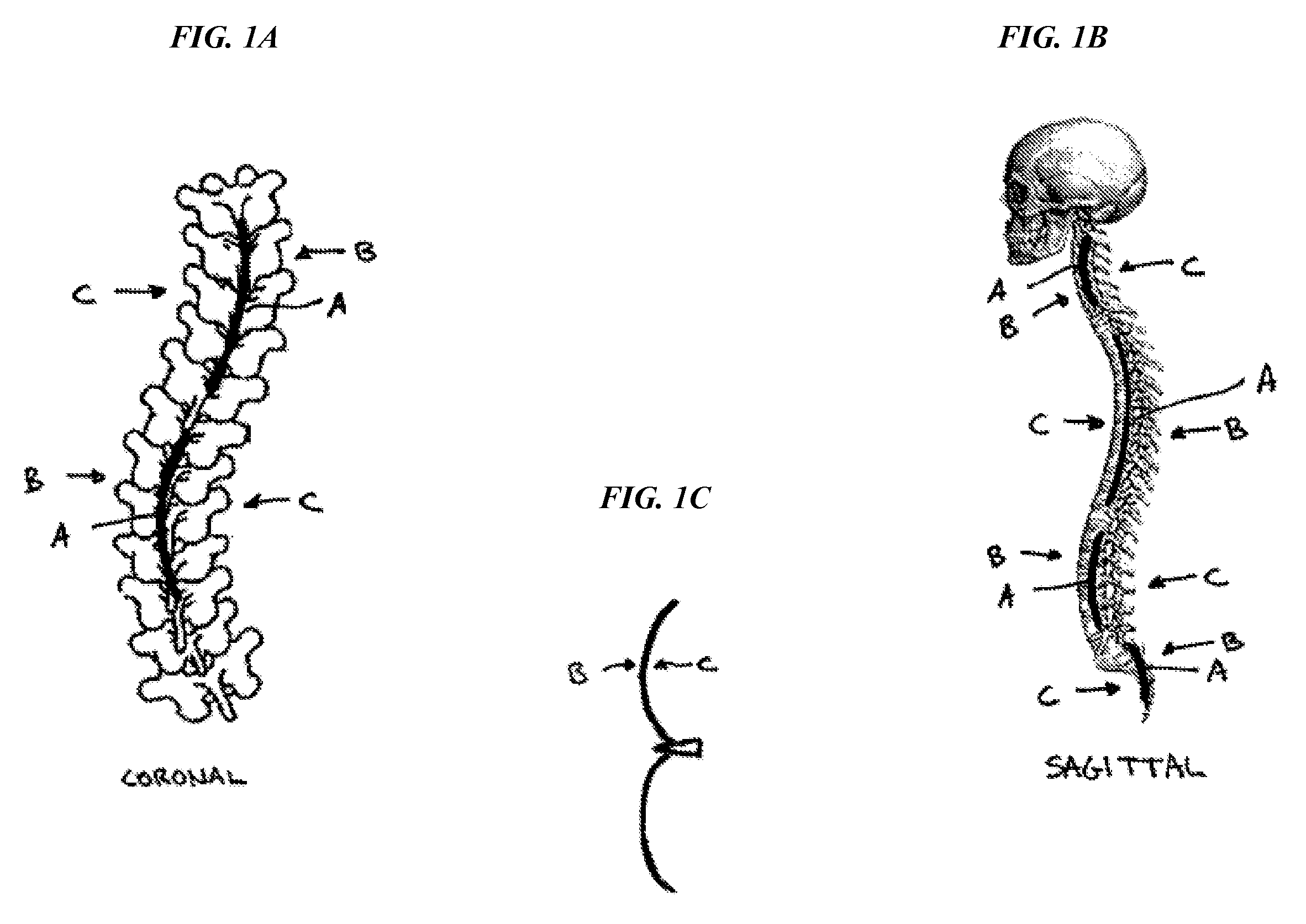 Methods and devices for correcting spinal deformities