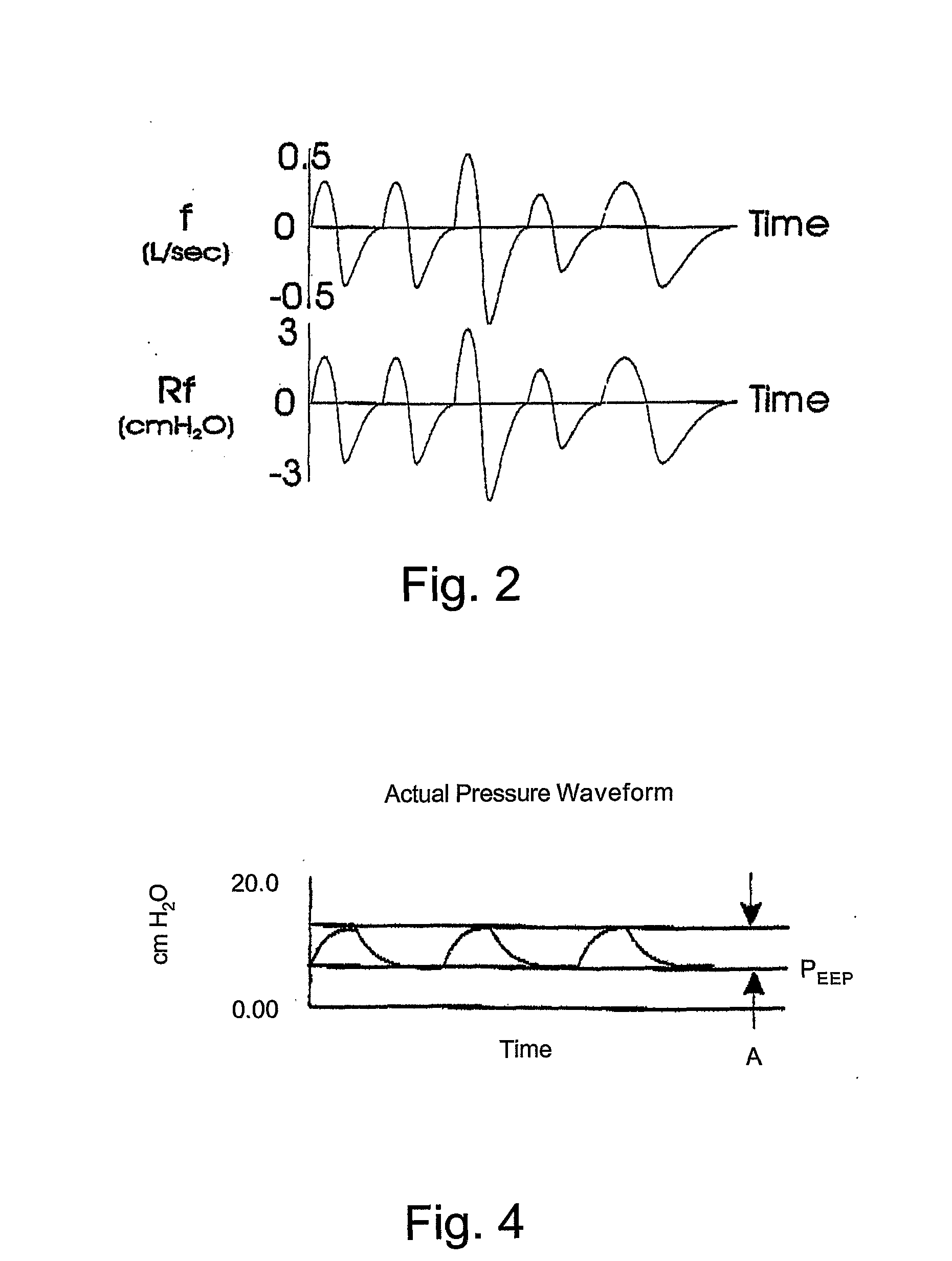 Pressure support ventilation of patients