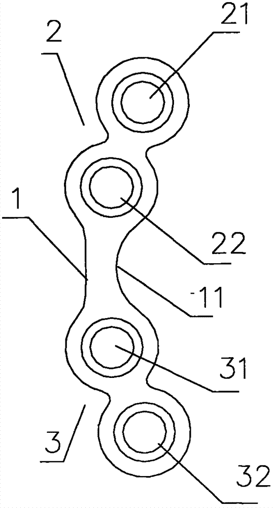 Arc-shaped cranio-maxillofacial bone plate