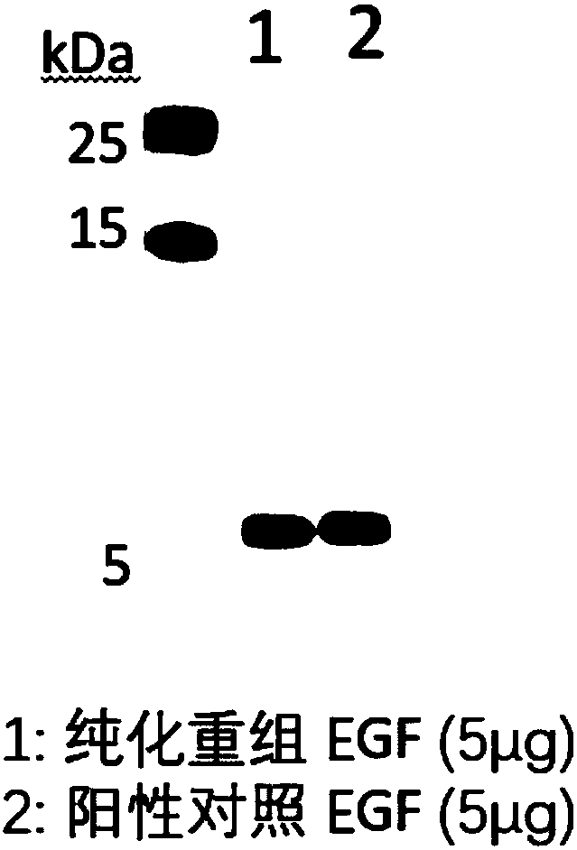 Application of plant serving as host in expressing epidermal growth factor