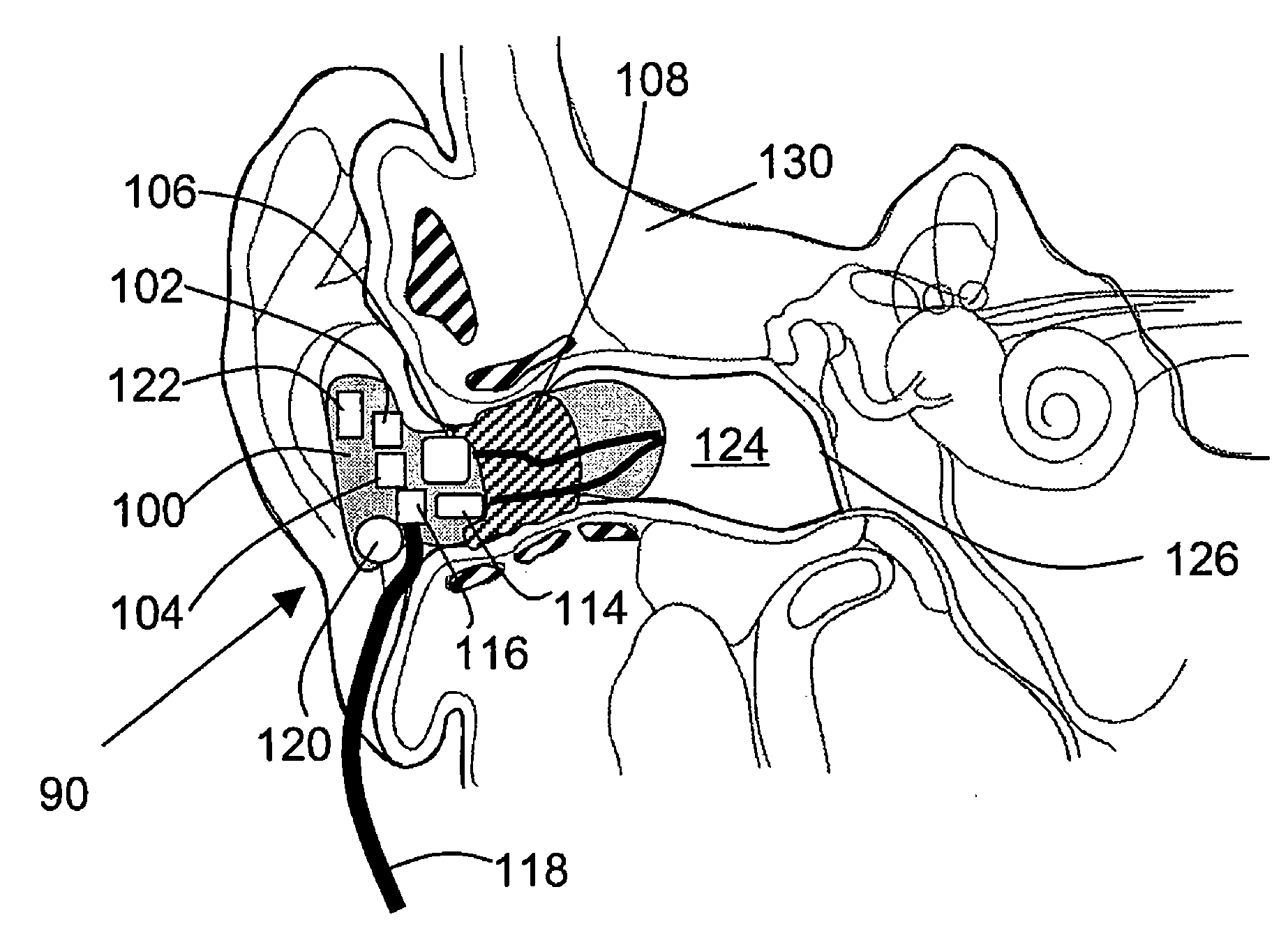 Orifice insertion devices and methods