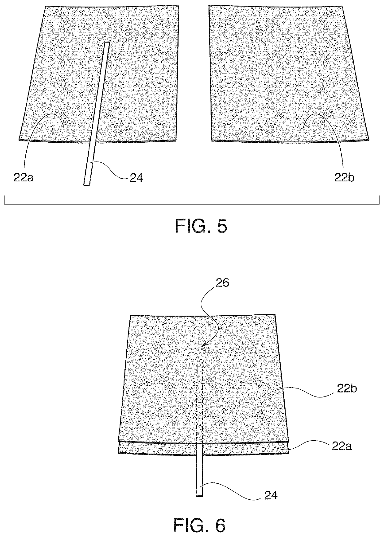 Channel implant