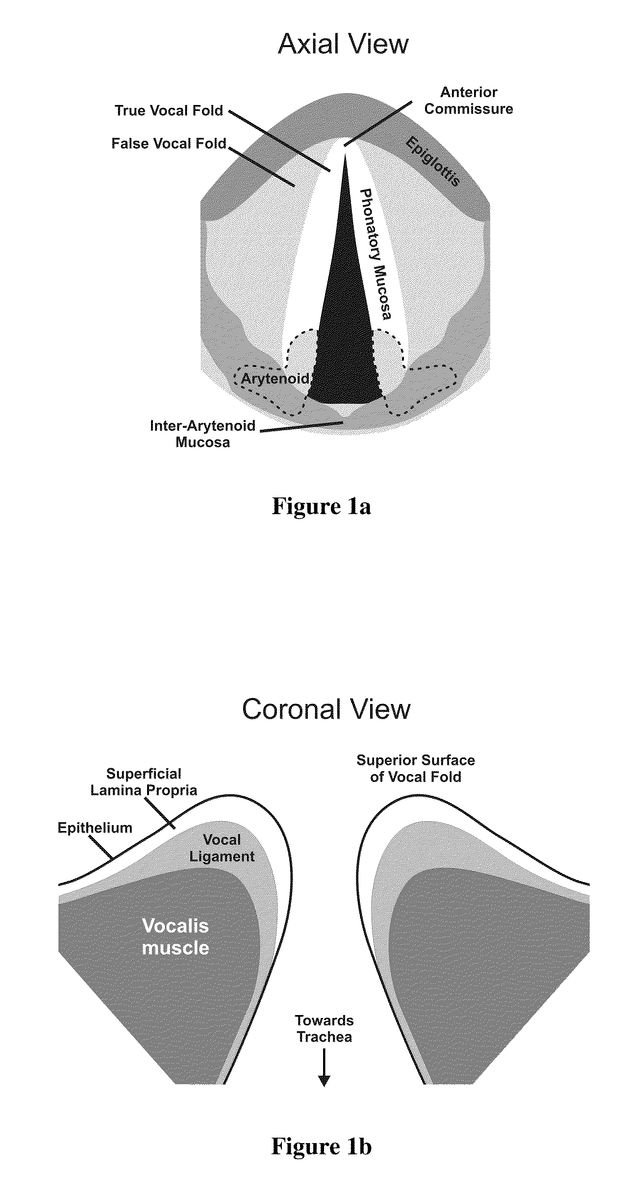 Hydrogels for vocal cord and soft tissue augmentation and repair