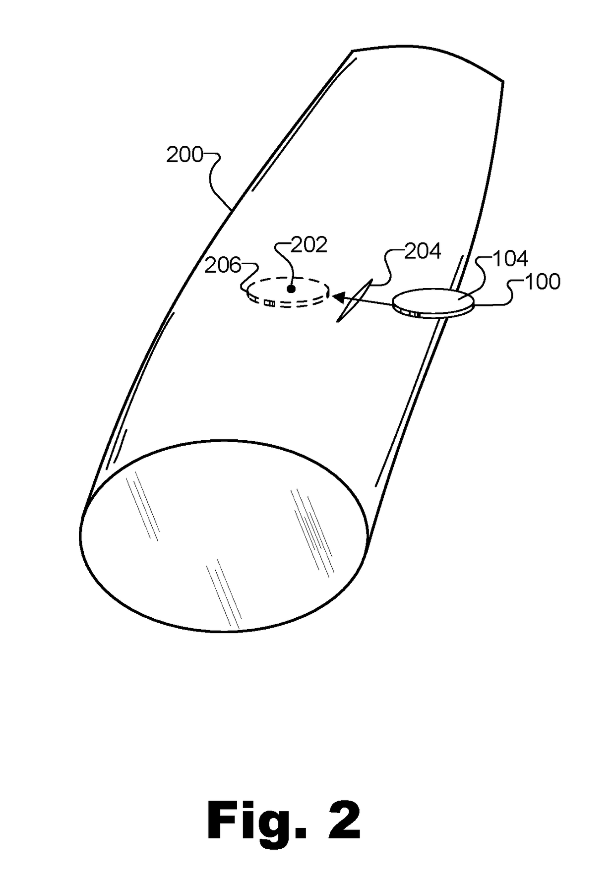 Methods and Systems for Treating Overactive Bladder Using an Implantable Electroacupuncture Device