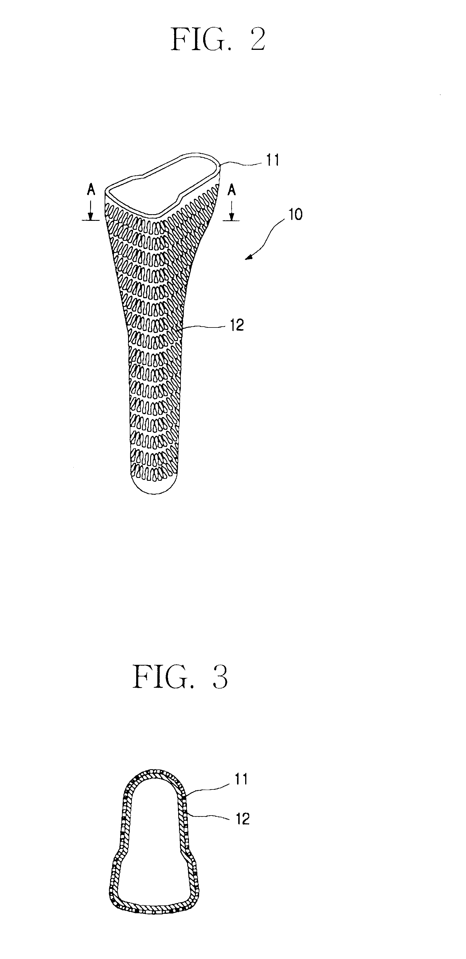 Metal jacket for a cementless artificial joint stem and artificial joint having the jacket