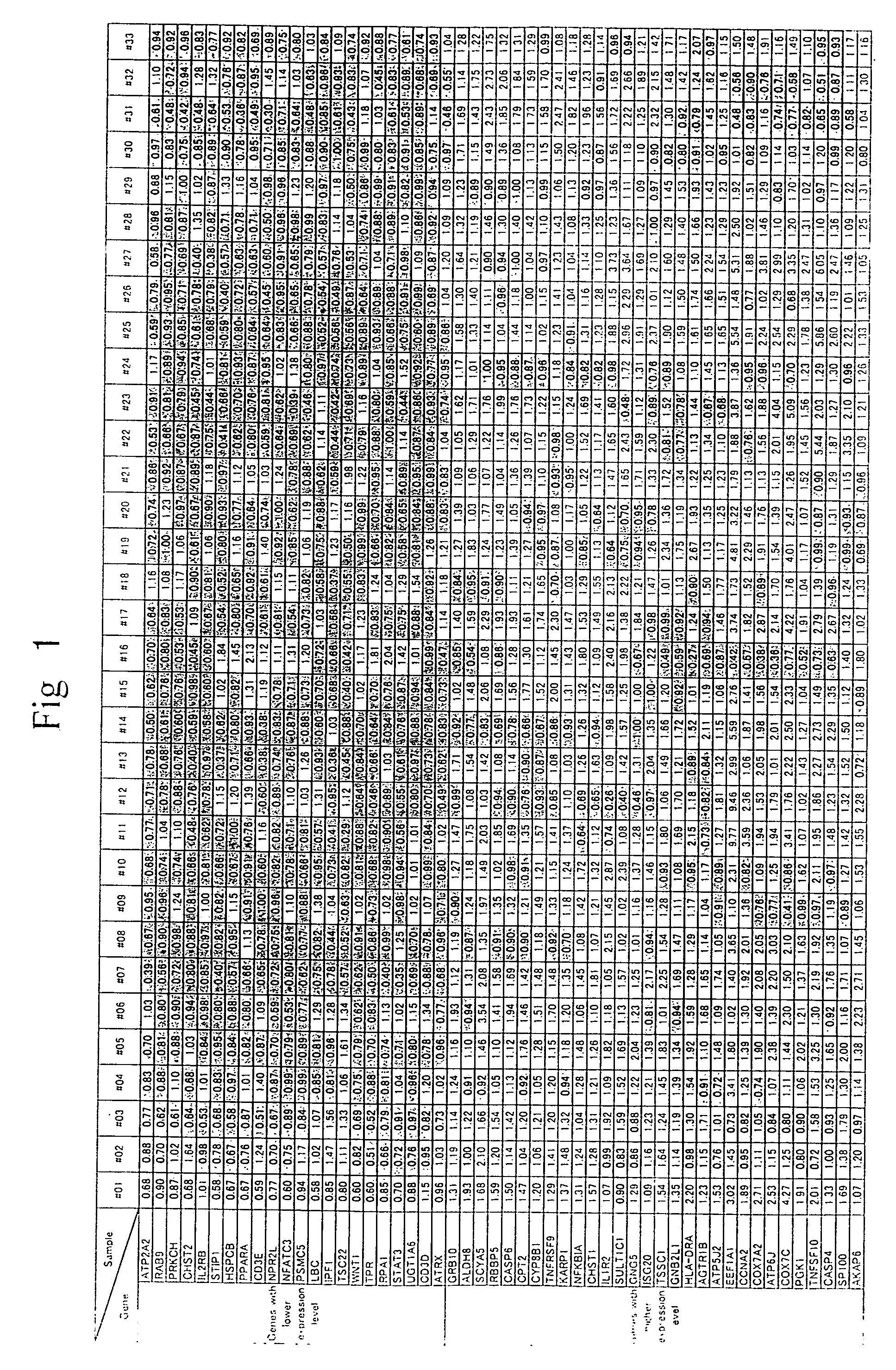 Method of diagnosing depression