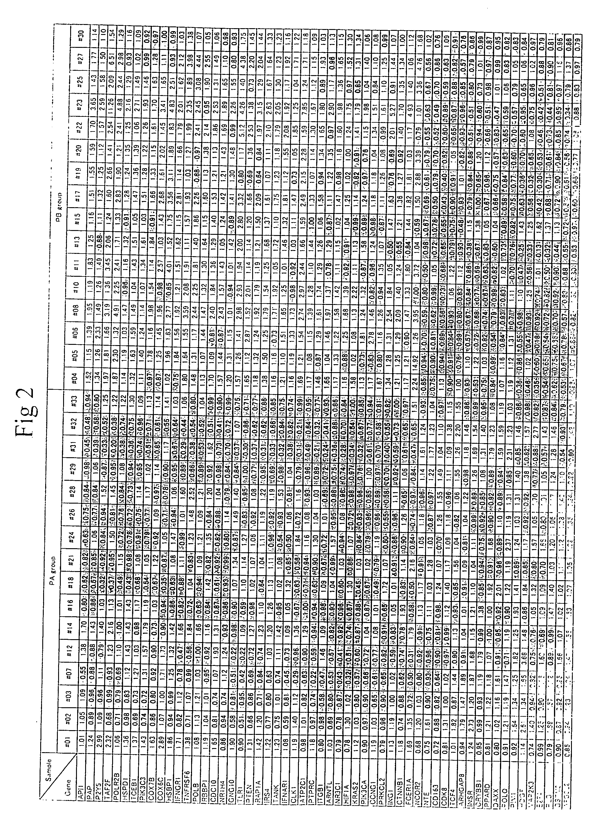 Method of diagnosing depression