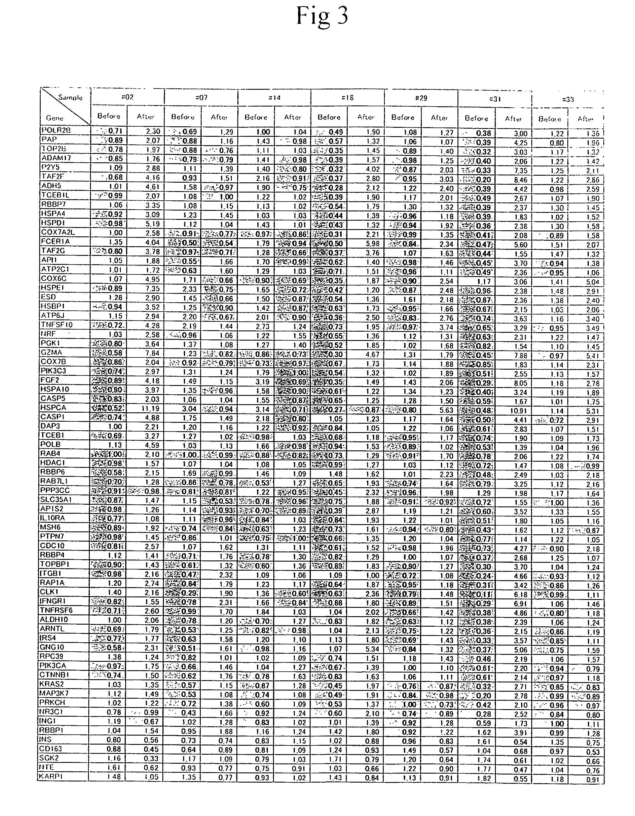 Method of diagnosing depression