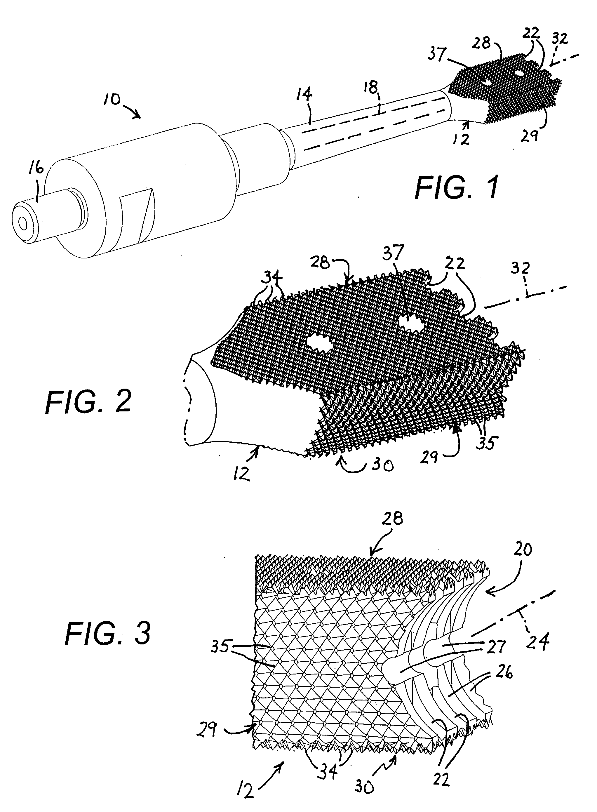 Ultrasonic spinal surgery method