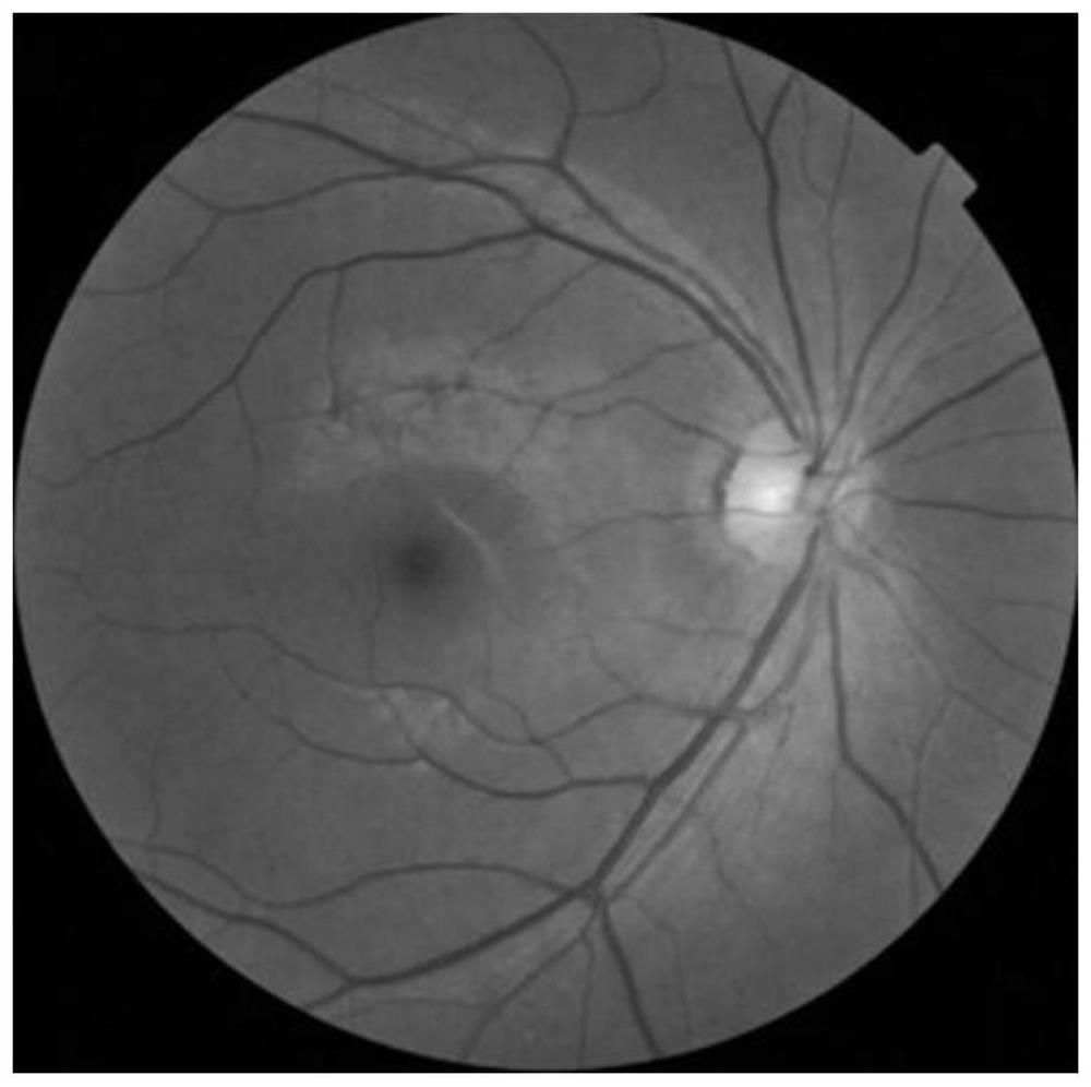 Method for determining width of ocular fundus disc, device and system for diagnosing glaucoma diseases