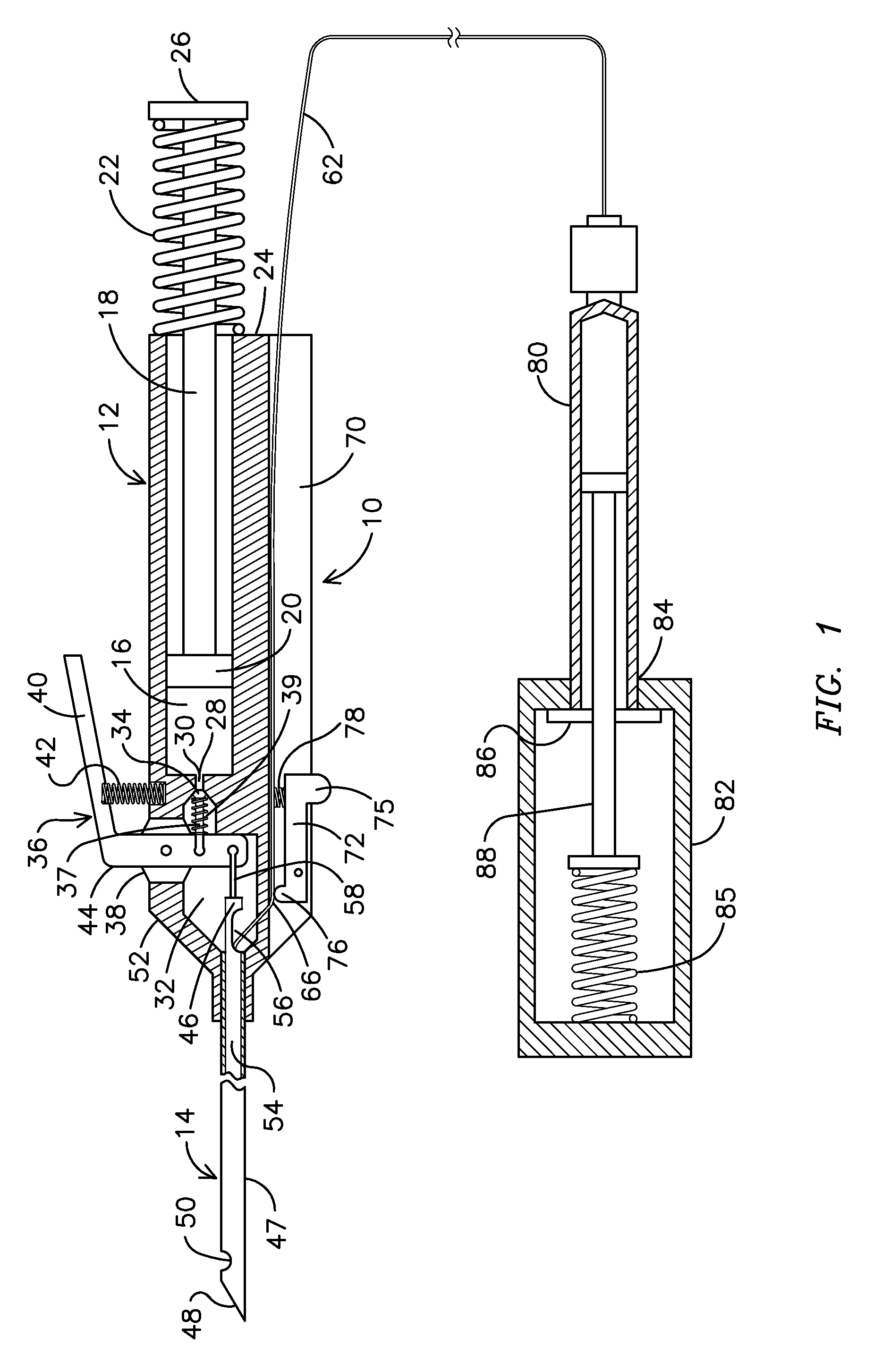 Retractable tip for vitrectomy tool