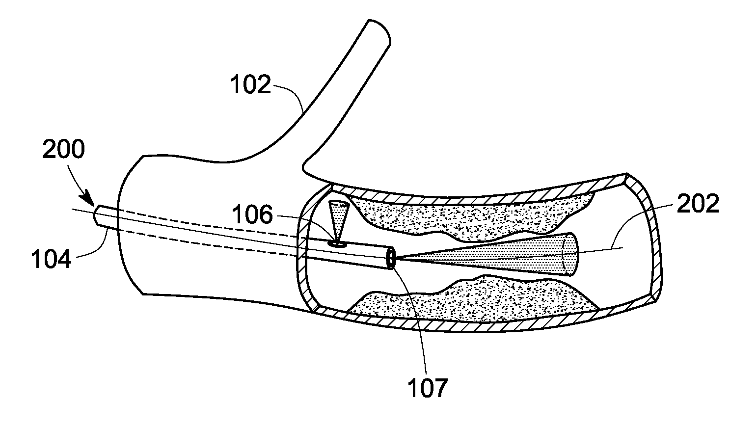 Methods and systems for intravascular imaging and flow measurement