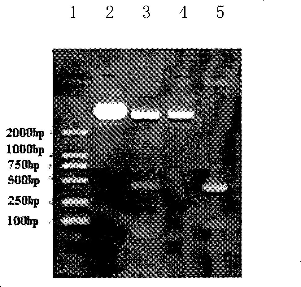 Staphylokinase and expression vector thereof