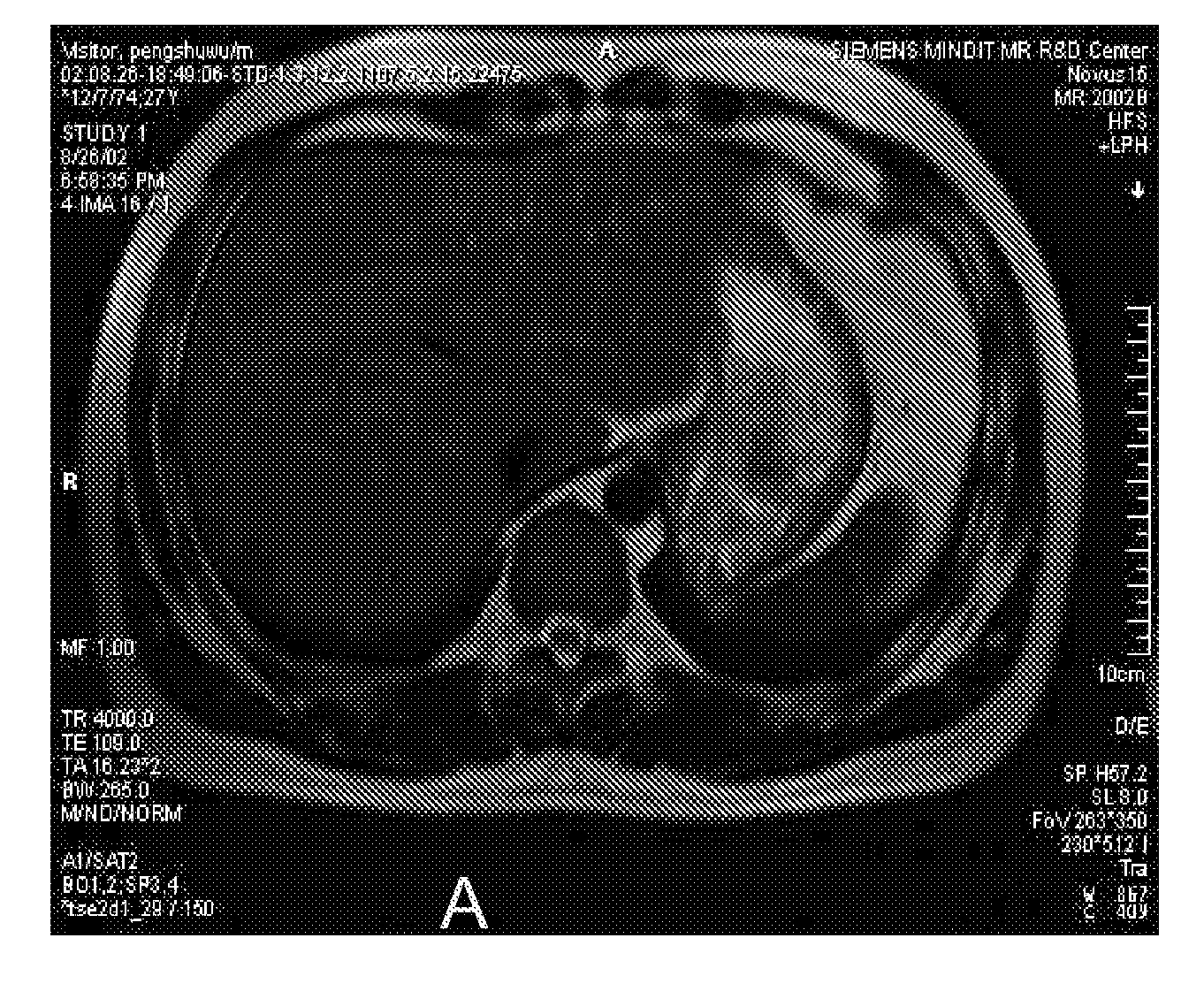 Motion Compensated MR Imaging System