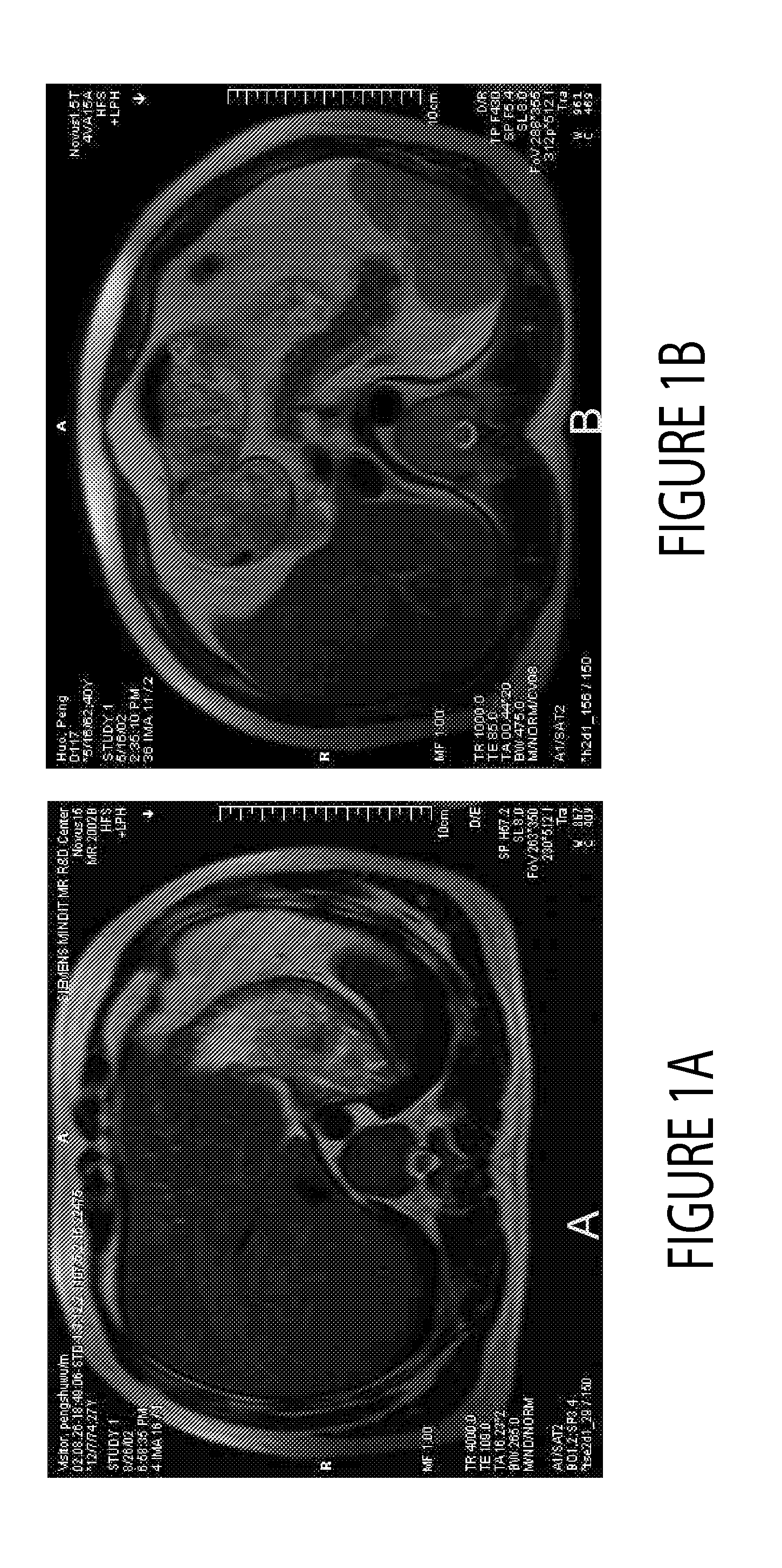 Motion Compensated MR Imaging System