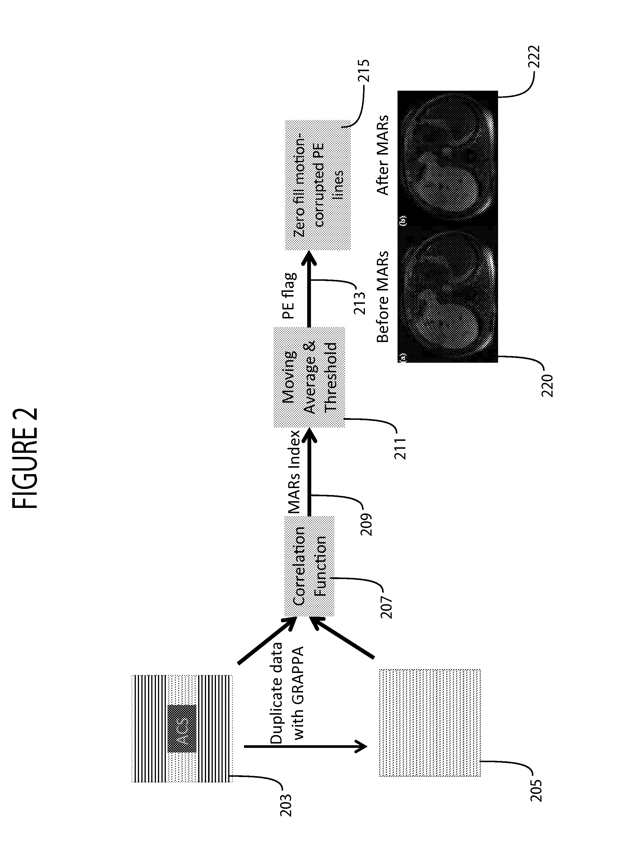 Motion Compensated MR Imaging System