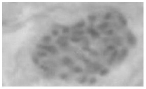 Application of combination of chemical mutagenesis method and negative pressure method in chionanthus retusus polyploid breeding