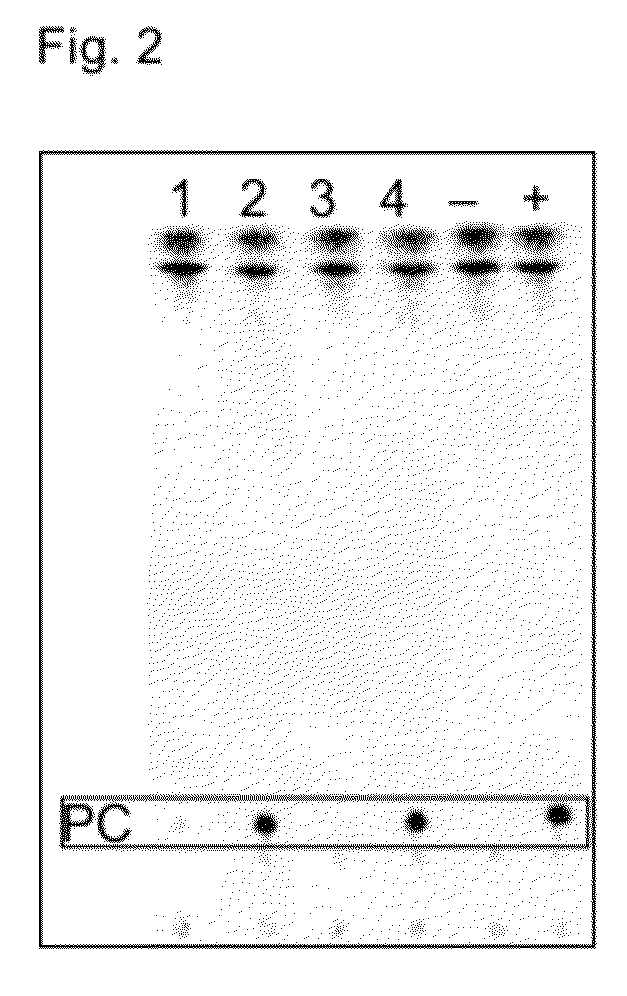 Acyltransferases and uses thereof in fatty acid production