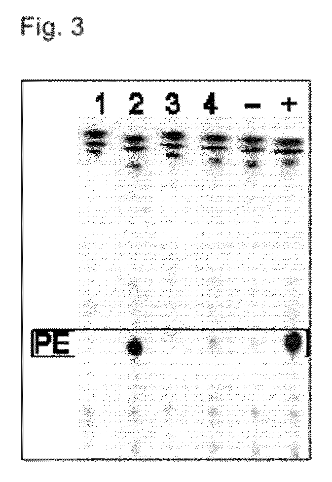 Acyltransferases and uses thereof in fatty acid production