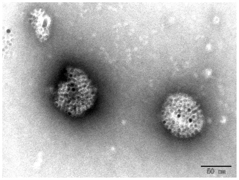 Tumor targeted diagnosis and treatment integrated nanoparticle and application thereof