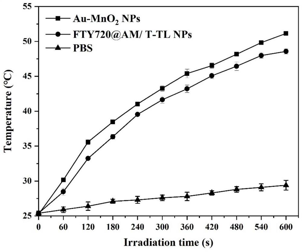 Tumor targeted diagnosis and treatment integrated nanoparticle and application thereof