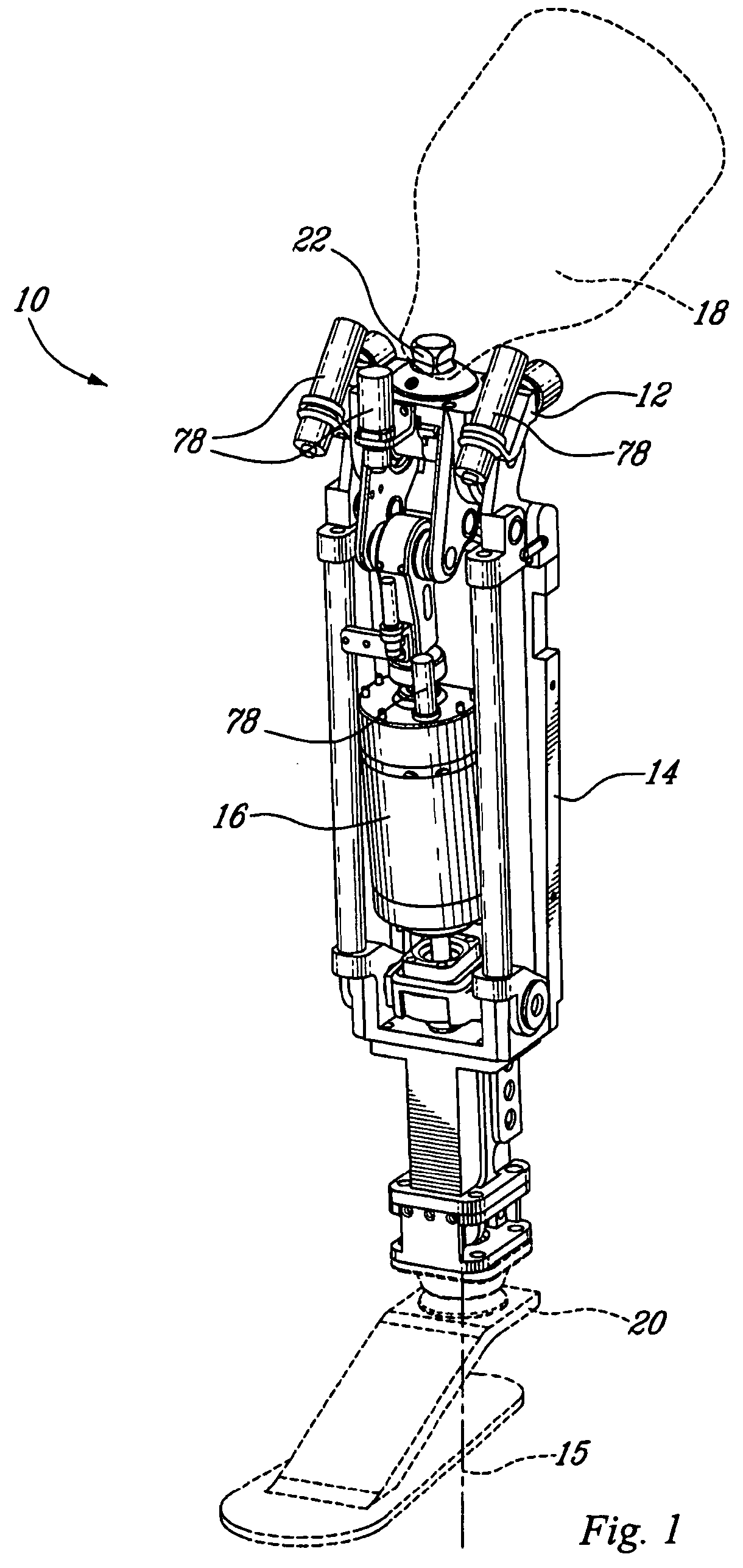 Actuated prosthesis for amputees