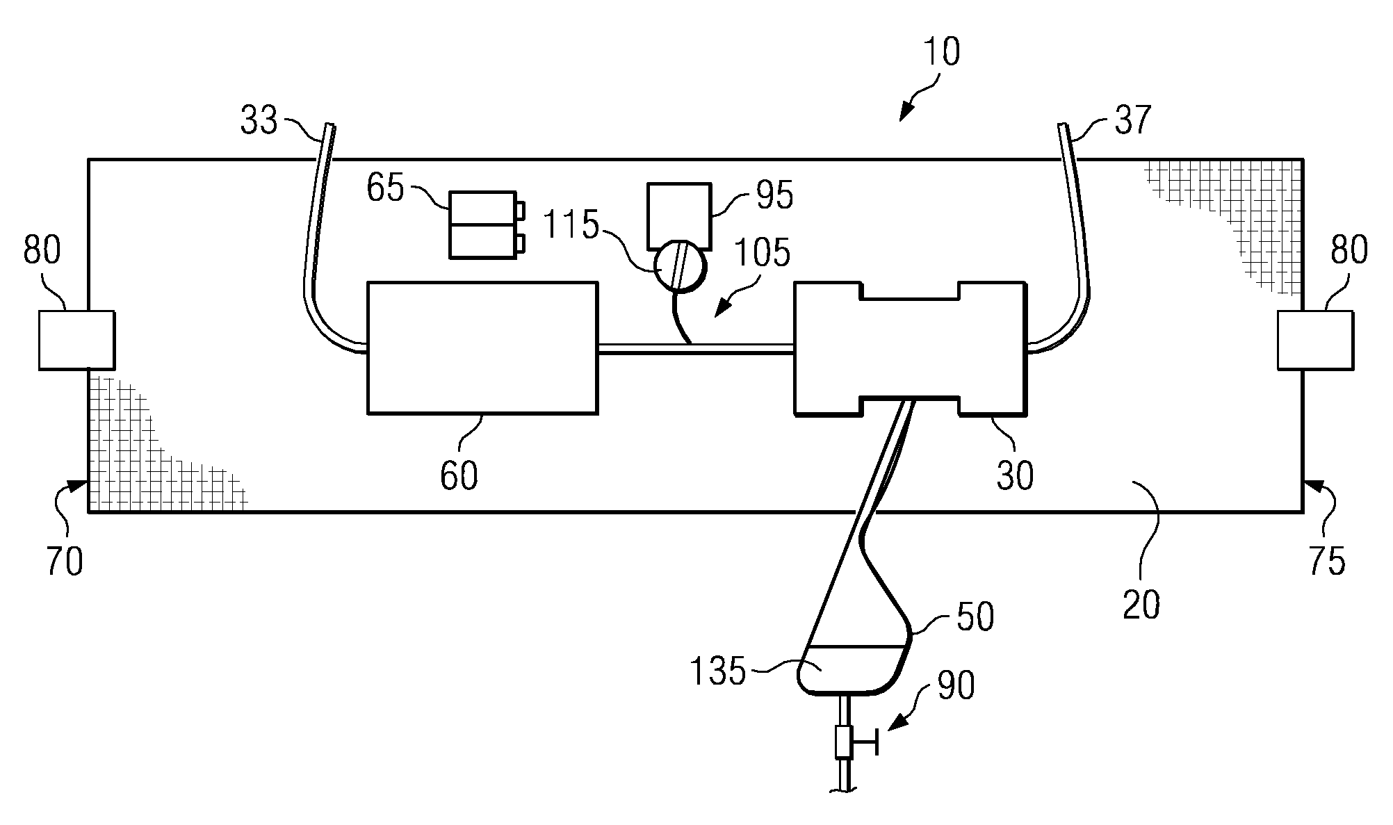 Wearable ultrafiltration device