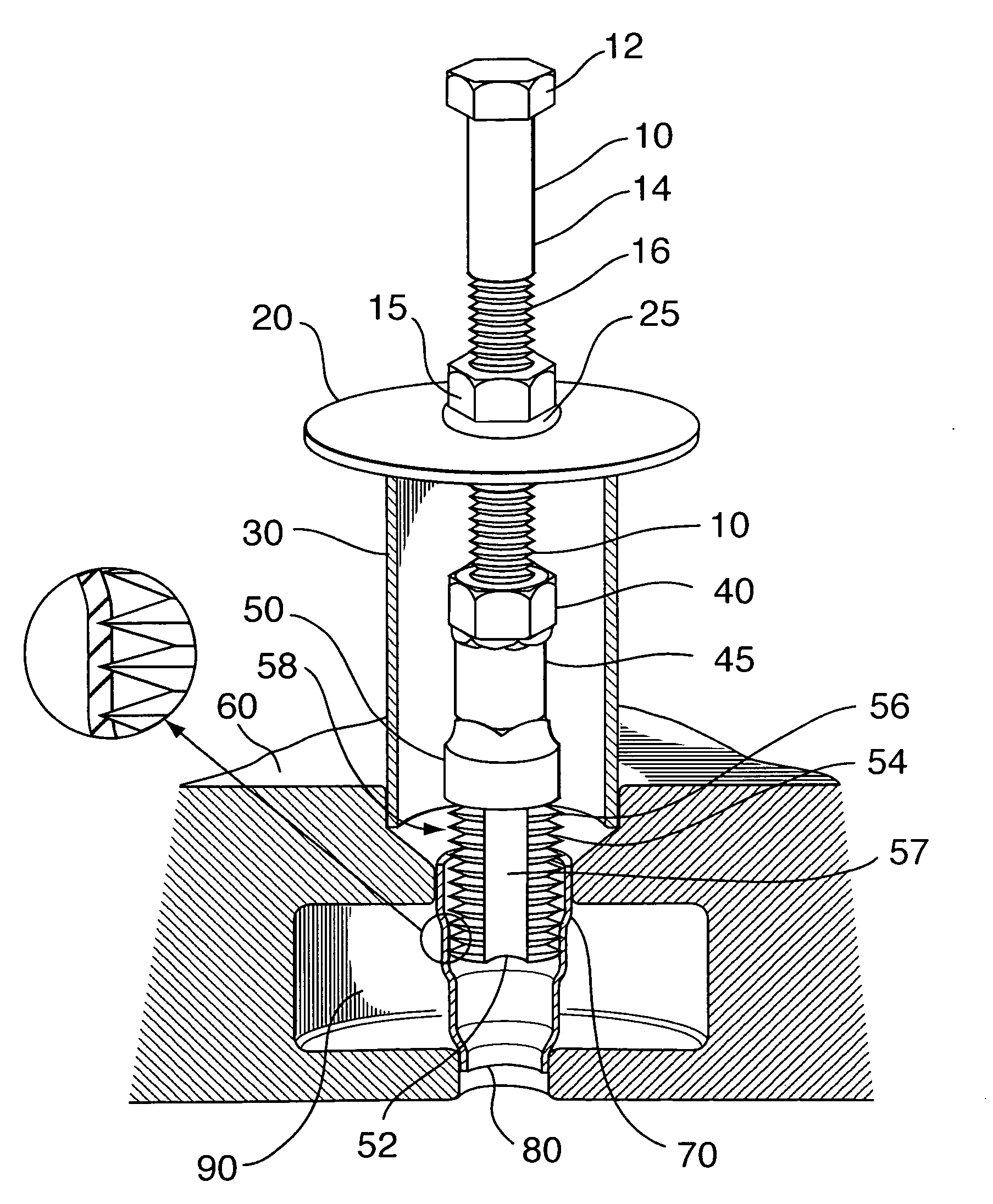 Injector sleeve removal tool