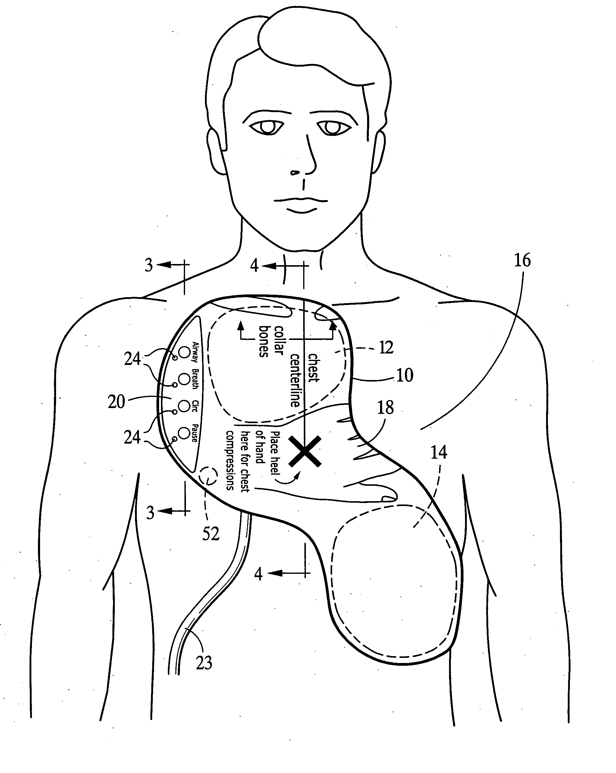 Integrated resuscitation