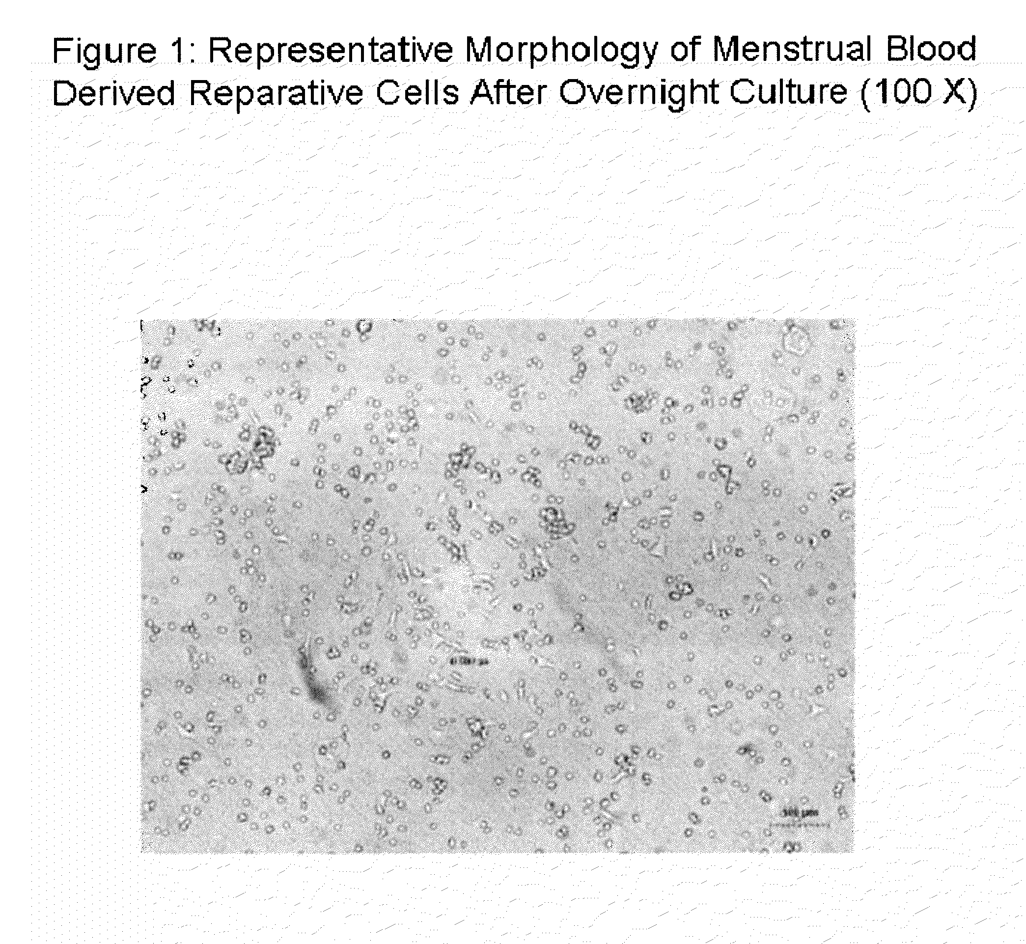 Endometrial stem cells and methods of making and using same