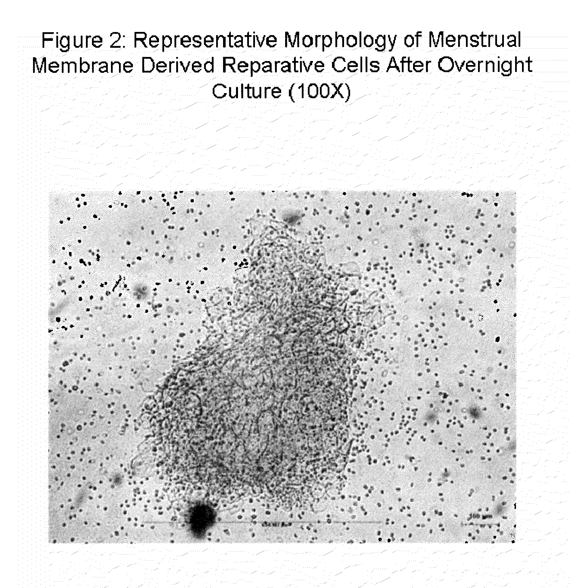 Endometrial stem cells and methods of making and using same