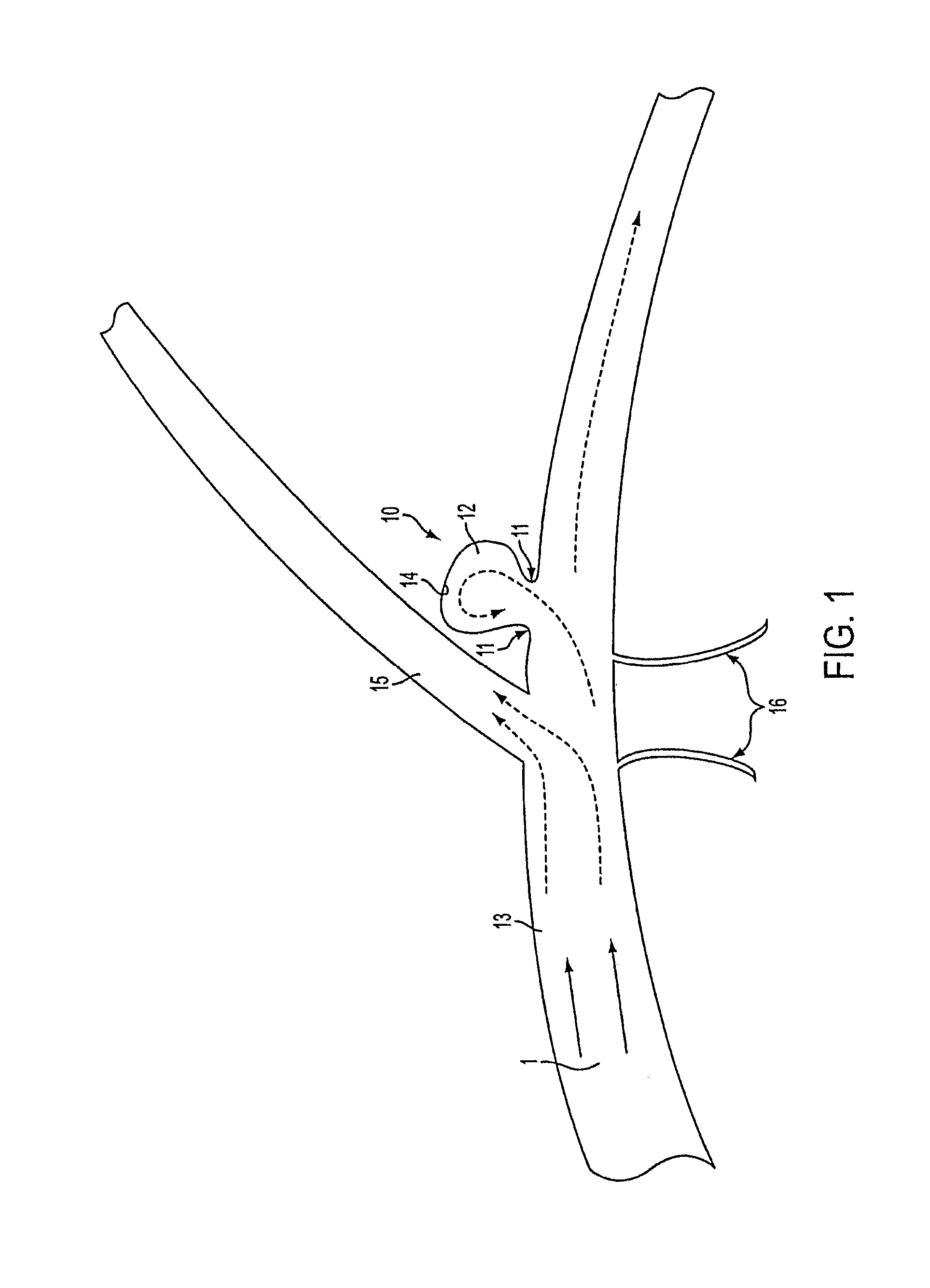 Flexible vascular occluding device