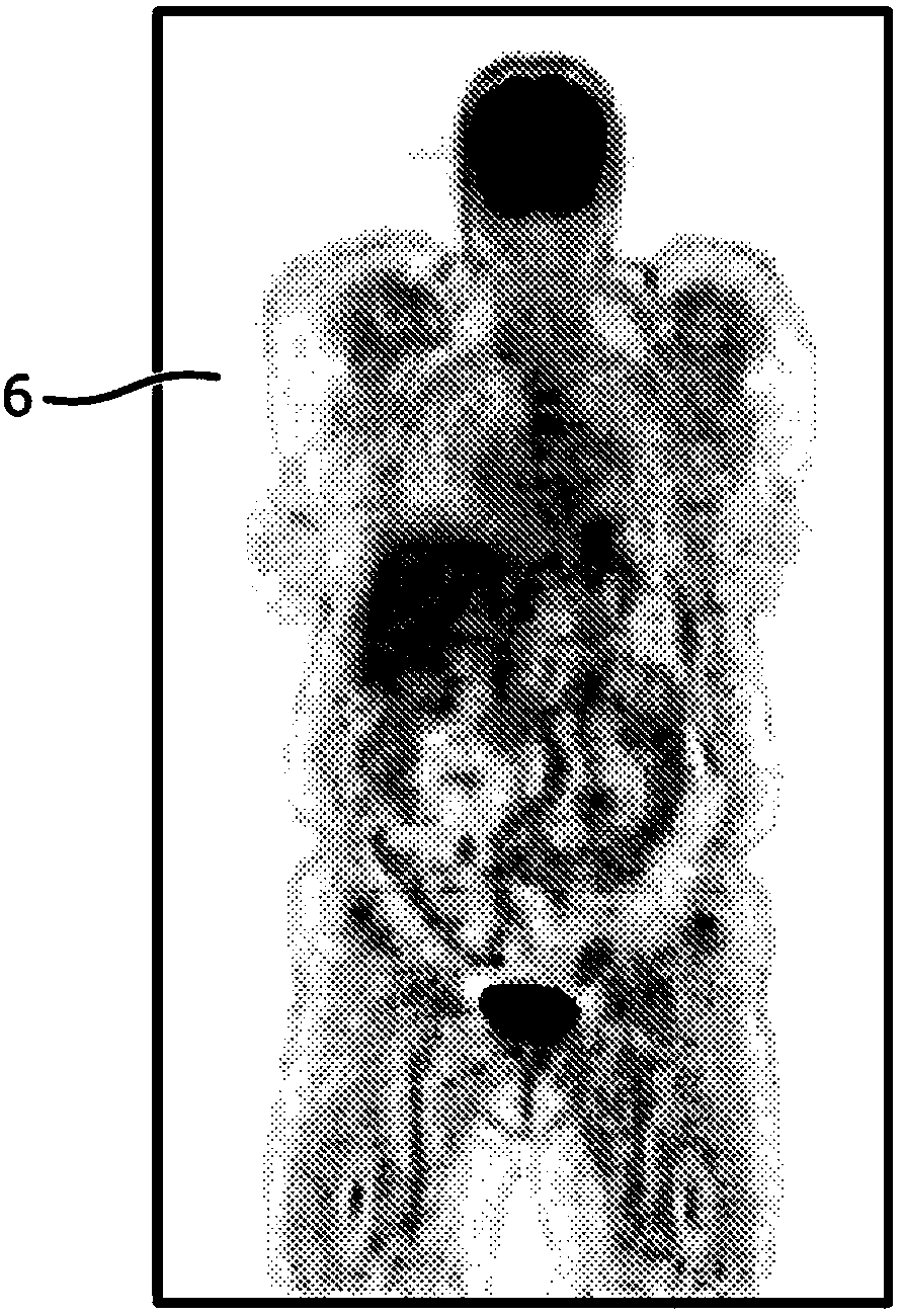 Apparatus and method for fast scatter estimation in pet reconstruction