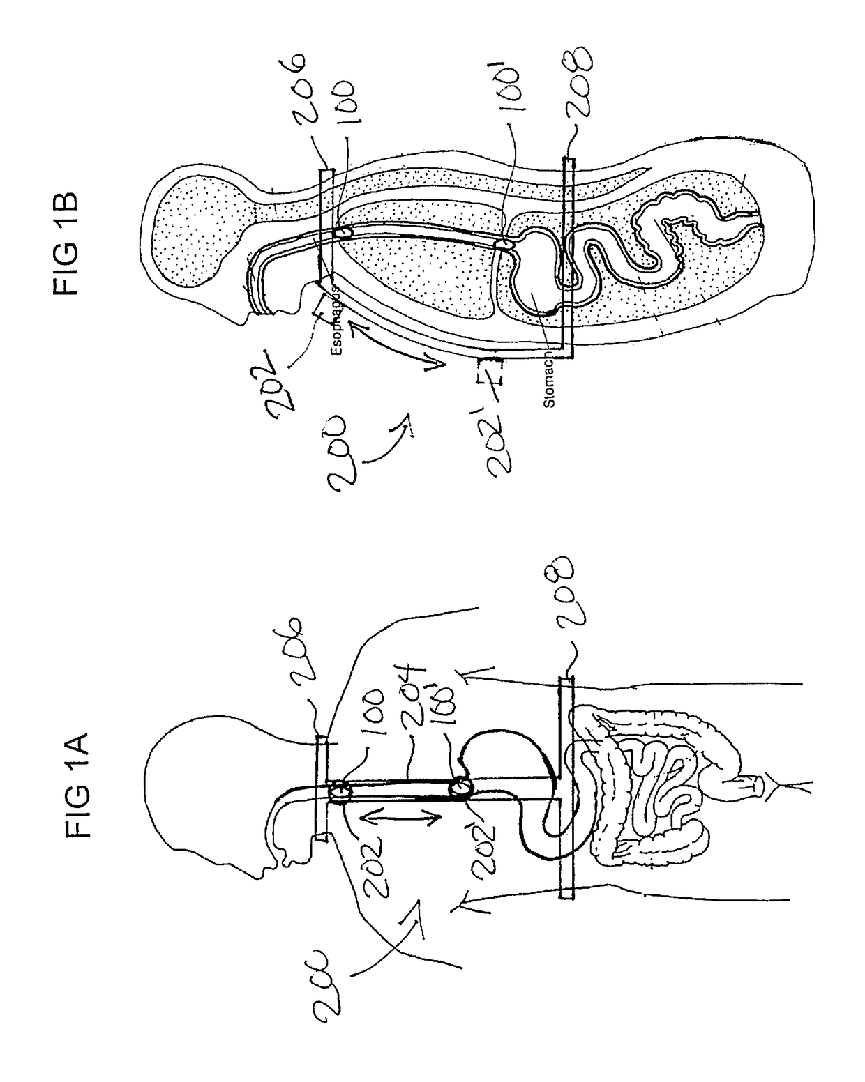 Apparatus and methods for capsule endoscopy of the esophagus